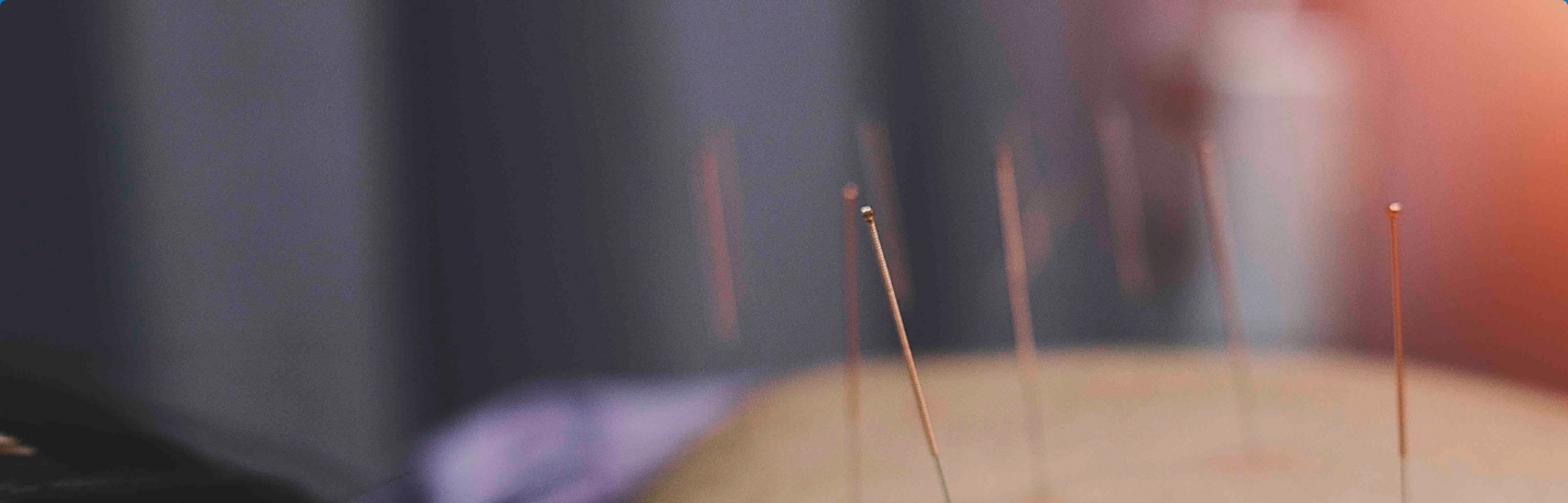 header-agopuntura