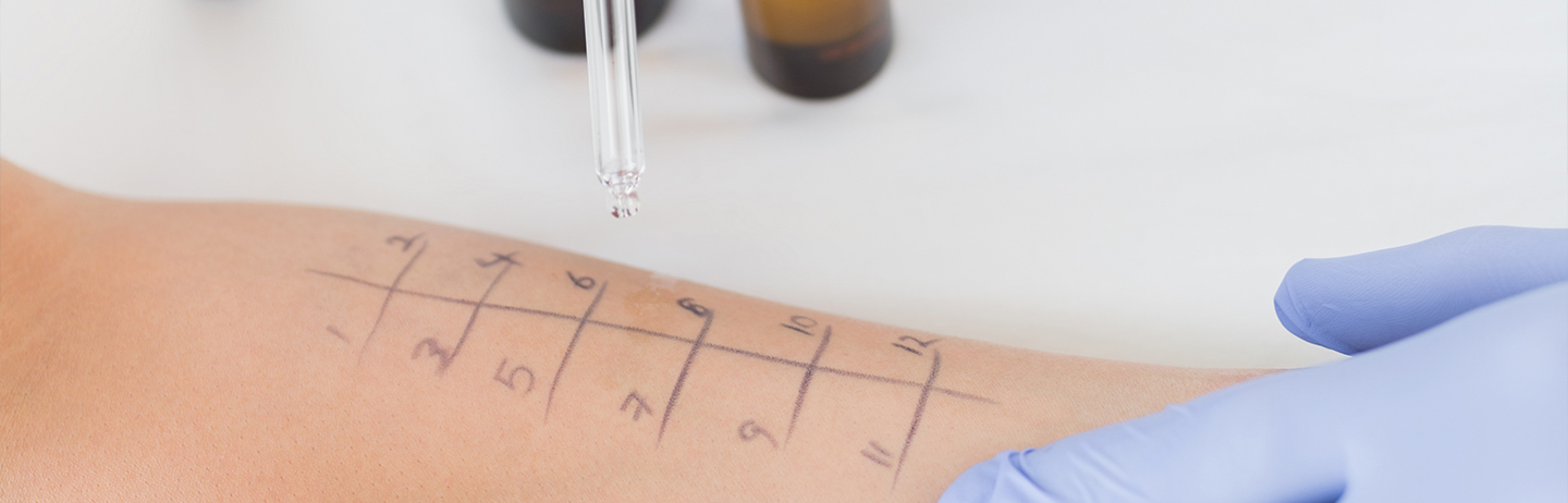 header-allergologia